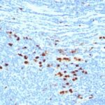 Formalin-fixed, paraffin embedded human tonsil sections stained with 100 ul anti-Calprotectin (clone MAC387) at 1:200. HIER epitope retrieval prior to staining was performed in 10mM Citrate, pH 6.0.